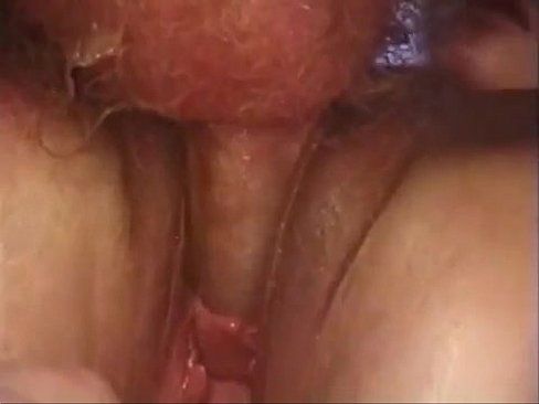 Peehole stretching deep thick